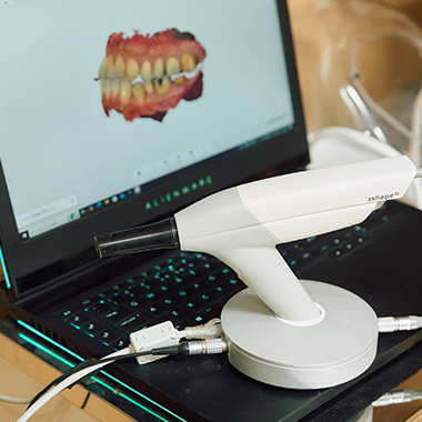 口腔内スキャナーTRIOS